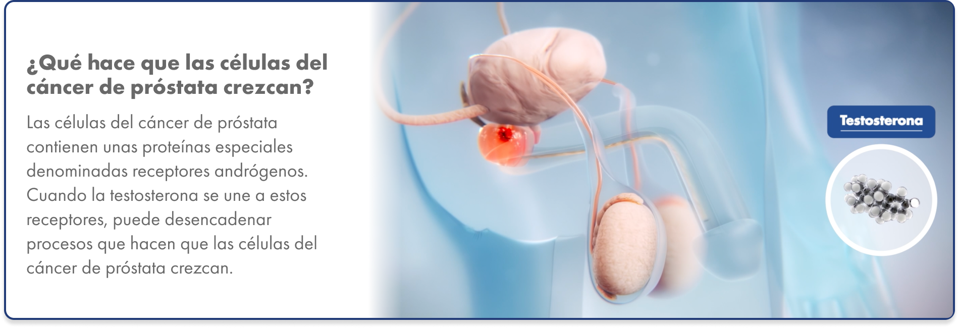 Interacción entre las células del cáncer de próstata y el receptor de andrógenos Gráfico de la unión de la testosterona a los receptores de andrógenos en las células del cáncer de próstata, lo que provoca que se multipliquen.